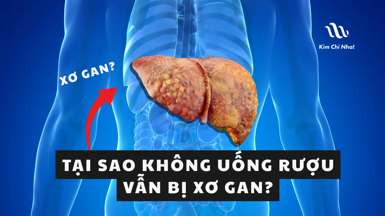 ⚠️ Không uống giọt rượu nào vẫn bị xơ gan