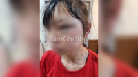 Đánh đập nữ công nhân Việt Nam nhập cư, nam quản lý 40 tuổi lĩnh án tù